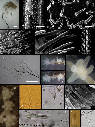 Figure 1 Antipathella subpinnata. A, dry colony. B, spines on an apical portion of the axis (2 mm in diameter). C, dendritic spines at the base of the axis. D,E, conical spines on a major branch (0.3 mm in diameter). F, spines on a primary pseudo‐pinnule (0.1 mm in diameter). G, arrangement of pseudo‐pinnules on a branch. H,I, arrangement of polyps on pinnules. L, living polyp. M, fixed polyps. N, p‐Mastigophore microbasic 29×6 µm (shaft 9.6 µm long). O, p‐Mastigophore microbasic 22×5 µm (shaft 8 µm long). P, SEM photo of tentacular spirocysts. Q,R, basitrich isorhizas 20×3 µm. S, basitrich isorhiza 9×2 µm. Scale Bar: N–S, 10 µm; E, 100 µm; C, D, F, L, 200 µm; H, I, M, 700 µm; B, 1 mm; G, 1 cm; A, 10 cm.
