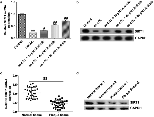 Figure 4. Liquiritin increases SIRT1 expression in ox-LDL-induced hVSMCs. The mRNA expression levels of SIRT1 in ox-LDL-induced hVSMCs were detected by RT-qPCR analysis. (b) The protein expression levels of SIRT1 in ox-LDL-induced hVSMCs were detected by Western blot analysis. (c) The mRNA expression levels of SIRT1 in plaque and normal tissues of 30 coronary heart disease patients were detected by RT-qPCR analysis. (d) The protein expression levels of SIRT1 in plaque and normal tissues of two random coronary heart disease patients were detected by Western blot analysis. **P < 0.01 vs. Control; #, ## P < 0.05, 0.01 vs. ox-LDL group; $$ P < 0.01 vs. Normal tissue.