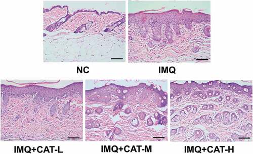 Figure 2. The role of catalpol on the IMQ-induced pathological injury was analyzed by H&E staining. Scale bar = 200 μm. The typical images of 6 repetitions from each group