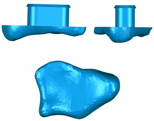 Figure 2 Anterioposterior view, lateral view, and vertical view of 3D model of polyethylene liner.Abbreviation: 3D, three-dimensional.