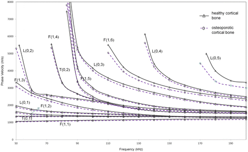 Figure 5. Phase velocity dispersion curves from SAFE analysis for extended model 2 (solid, dashed) (healthy and osteoporotic cortex filled with marrow and coated with soft tissue).