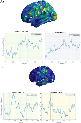 Figure 5. Word frequency. A. Stimulus-locked data. Top panel. Cortical distribution of the above chance decoded activity specific to word frequency in widespread brain regions. Bottom panel: Time course of the above chance decoded activity in the LIFG BA 45 and 43, with effects present within the first 600 ms post-stimulus onset. B. Response-locked data. Top panel. Cortical distribution of the above chance decoded activity specific to word frequency in widespread brain regions. Bottom panel: Time course of the above chance decoded activity in the LIFG BA 37 and BA 39, with peaks around −700 ms before speech onset.