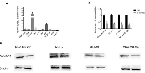 Figure 3 SYNPO2 has low expression in BC cell lines.Notes: (A) The relative expression of SYNPO2 gene (compared with the GAPDH gene) using qRT-PCR. Compared to the other cell lines, SYNPO2 was expressed at a higher level in MCF-7, MDA-MB-231, BT-549, and MDA-MB-468. (B and C) The relative expression of SYNPO2 gene (compared with the GAPDH gene) in MCF-7, MDA-MB-231, BT-549, and MDA-MB-468 and both mRNA and protein levels of SYNPO2 were significantly reduced. Compared with the corresponding control group, the expression of SYNPO2 gene in the siRNA group was lower. *P<0.05.Abbreviations: BC, breast cancer; qRT-PCR, quantitative reverse transcription polymerase chain reaction; SYNPO2, synaptopodin 2.