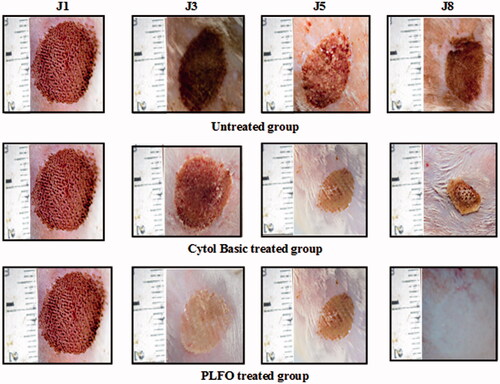 Figure 1. Digital photographs of the wound surfaces in each group on 1st, 3rd, 5th and 8th days. A, B and C laser wounds treated with saline solution with 6.81%, 15.45% and 32.27% wound closure on 3rd, 5th and 8th days, respectively. D, E and F laser wound treated with ‘CYTOL BASIC®’ with 9.11%, 20% and 61.36% wound closure on 3rd, 5th and 8th days, respectively. G, H and I laser wound treated with PLFO with 41.81%, 60% and 100% wound closure on 3rd, 5th and 8th days, respectively.