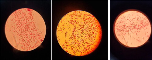 Figure 5. Microscopic images of Escherichia coli after re-cultivation (24 h at 37 °C) of the strains from the lyophilized form stored for four to five decades. Slides were prepared by Gram staining and were observed under immersion system, 100x (Carl Zeiss microscopy GmbH, Primo star).Note: E. coli strains from left to right O11, O25 and O111.