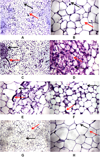 Figure 1 Effects of DG on HFD-induced histopathological changes in adipose tissues of mice. (A) and (B) Adipose tissue section from the control: (A) adipose tissue showing average uni-vacuolated adult fat cells (black arrow) with average extracellular matrix (red arrow), (B) high-power view showing uni-vacuolated adult fat cells with compressed nucleus at one side (black arrow) with intact cell membrane (red arrow). (C–E) and (F) Adipose tissue sections from the HFD group: (C) adipose tissue showing closely packed variable-sized fat cells (black arrow) with fibrous connective tissue bands (red arrow), (D) high-power view showing closely packed overcrowded small-sized fat cells with multiple vacuoles (black arrow) with centrally located nuclei (red arrow), (E) adipose tissue showing ruptured fat cells (black arrow) with fibrous connective tissue bands (red arrow), (F) another view showing closely packed overcrowded small-sized fat cells (black arrow) with excess connective tissue (red arrow). (G) and (H) Adipose tissue sections from the HFD + DG group: (G) adipose tissue showing average uni-vacuolated adult fat cells (black arrow) with average extracellular matrix (red arrow), (H) high-power view showing univacuolated fat cells with compressed nucleus at one side (black arrow) and intact cell membrane (red arrow).
