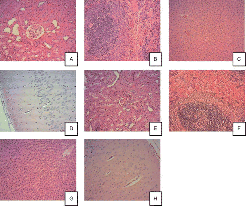 Figure 3.  Histopathological pictures of major organs from control animals (A–D) and animals treated with high dose, 10 mg/kg/day menaquinone-7 (MK-7) (E–H). All photos are 10× magnification and all the tissues are considered to be without histopathological findings. Control male rats (10×): renal cortex (A), spleen (B), liver (C), and cerebral cortex (D). MK-7 10 mg/kg/day male rats (10×): renal cortex (E), spleen (F), liver (G), and cerebral cortex (H).