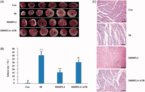 Figure 4. Myocardial pathology and infarct size. (A) Photos of myocardium after TTC staining. (B) Infarct size as a percentage of total size. (C) Photos of myocardium stained with HE (200×). Data were expressed as the mean ± SD (n = 6). ΔΔp < 0.01 vs. Con, **p < 0.01 vs. IR, #p < 0.05 vs. DHHP2.4.