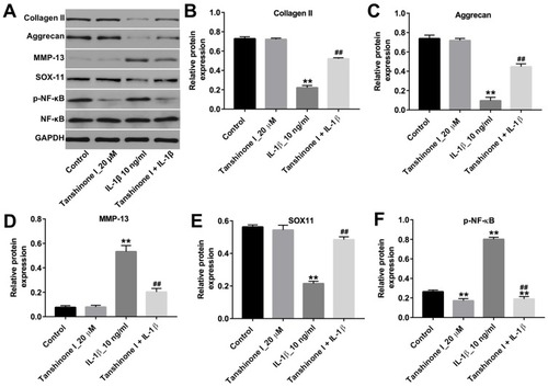 Figure 4 Tanshinone I prevented IL-1β-induced extracellular matrix degradation in CHON-001 cells. CHON-001 cells were pre-treated with 20 μM Tanshinone I for 24 hrs and then stimulated with or without IL-1β (10 ng/mL) for 72 hrs. (A) Expression levels of collagen II, aggrecan, MMP-13, SOX11 and p-NF-κB in CHON-001 cells were detected with Western blotting. GAPDH was used as an internal control. (B–E) The relative expressions of collagen II, aggrecan, MMP-13 and SOX11 were quantified via normalization to GAPDH. (F) The relative expression of p-NF-κB was quantified via normalization to NF-κB **P < 0.01 compared with control group; ##P < 0.01 compared with IL-1β 10-ng/mL group.