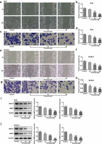 Figure 2. Fluvastatin suppresses the migration and invasion of EC cells. (a-b) The migration, (c-d) invasion, (e-f) migration, (g-h) invasion, (i-j) MMP12 and MMP9 expressions in EC cells exposed to fluvastatin. *P < 0.05, **P < 0.01, *** P < 0.001 versus control