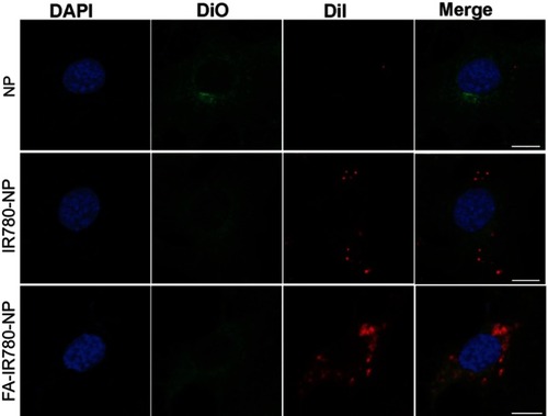Figure S1 Fluorescence images of a single SKOV3 cell incubated with NPs (NP, IR780-NP, FA-IR780-NP). Blue (DAPI) represents cell nuclei; green (Dio) reveals the cytomembrane; whereas the red (DiI) dots imply DiI-labeled NPs. The scale bars represent 5 μm.