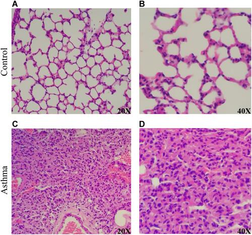 Figure 2 Pathological results of hematoxylin and eosin (HE) staining in the lungs of asthma and control mice. (A) The lung of normal control mice (20×). (B) The lung of normal control mice (40×). (C) The lung of asthmatic mice (20×). (D) The lung of asthmatic mice (20×).