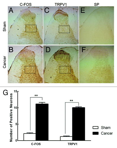 Figure 4. Immunohistochemical staining of spinal c-Fos, TRPV1 and SP. (A–F) Photographs of c-fos, TRPV1 and SP proteins’ ipsilateral dorsal horn profiles in both cancer-bearing and sham rats, respectively. (G) Number of c-fos and TRPV1 positive neurons in selected areas (black box, randomly selected 3 fields under 200 × magnification) for sham and cancer rats. Data are mean ± SEM, **p < 0.01.