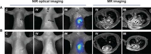 Figure 4 The in vivo NIR fluorescent signal and MR detections. No fluorescent signals were observed in the heart areas of control and IV groups at two time points, but the signals in IM groups lasted over 1 week. MR imaging showed that SPIO-labeled cells were visualized in the infarcted myocardium as hypointense areas by serial MRI studies from day 1 to day 7 in the IM group, but no signals were found in the IV group. A) One day after cell delivery. B) Seven days after cell delivery.Abbreviations: NIR, near-infrared; MR, magnetic resonance; SPIO, superparamagnetic iron oxide; C, control group; IV, intravenous group; IM, intramyocardial group.