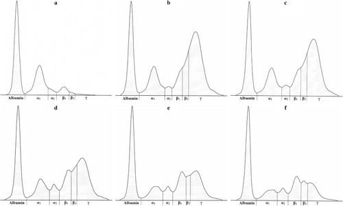 Figure 1. Electrophoreograms in a calf showing the protein fractionation into six fractions: albumin, α1-, α2-, β1-, β2- and γ-globulins during the first month of life in precolostral serum – day 0 (a), on day 1 (b), day 2 (c), day 7 (d), day 14 (e) and day 30 (f).