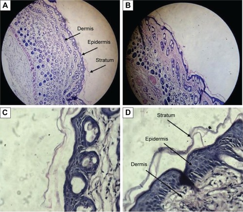 Figure 11 Histological microphotographs of vertical section of mouse skin after hematoxylin and eosin staining.Notes: (A) Skin sample treated with placebo capryol-based LCG (FC) at low-power view (×100); (B) skin sample treated with Tr-loaded capryol-based LCG (1% w/w) at low-power view (×100); (C) skin sample treated with placebo capryol-based LCG at high-power view (×400); (D) skin sample treated with Tr-loaded capryol-based LCG at high-power view (×400).Abbreviations: FC, 38.46% lecithin, 46.16% capryol, and 15.38% water; LCG, liquid crystalline nanogel; Tr, terconazole.