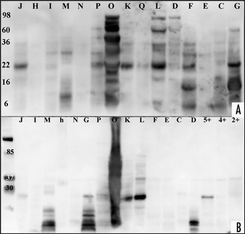 Figure 1 Western blot analysis of CJD, disease and healthy controls. Urine samples of patient and control samples underwent proteolytic digestion with two different PK concentration and incubation time and were probed with anti-IgG-HRP anitbody. (A) Enriched urine samples from sCJD, vCJD, disease and healthy controls were treated with proteinase K (concentration 40 µg/ml for 20 min). Samples ID labelled with letters correspond to Table 1. After electrophoresis, protein was transferred to a nylon membrane using Bio-Rad instrument and probed with anti-IgG-HRP followed with ECL Plus addition. A Kodak Imager was used for photographic documentation. (B) Same or other samples were treated with proteinase K (concentration 60 µg/ml for 30 min). Samples ID labelled with letters correspond to Table 1, healthy control samples are shown with numbers. Protein was transferred via Bio-Rad and membrane probed with anti-IgG-HRP followed ECL Plus addition. Documentation was as above. (The exposure time for documentation was 5 minutes for A and B).