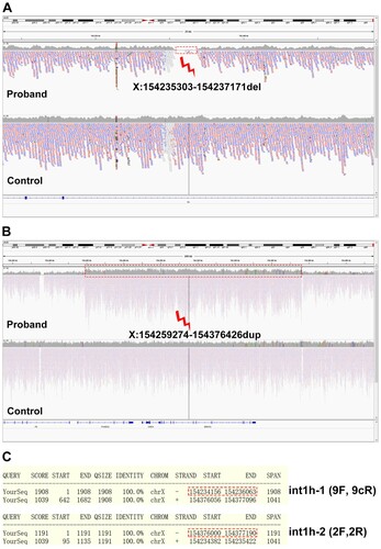 Figure 3. Coverage analysis of the WGS data. A, A large deletion crossing X:154235303-154237171 (hg19) was found in the boy. B, A large duplication including X:154259274-154376426 (hg19) was identified by the coverage analysis. C, The genomic regions of int1h-1 and int1h-2 amplified using 9F+9cR and 2F+2R respectively. The red dotted line labeled int1h-1 or int1h-2, and the bottom region was the almost identical region.