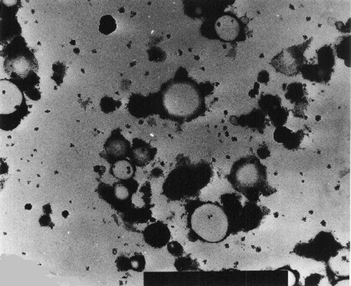 Figure 6 TEM micrograph of Fromase milk coagulum (30,000×).
