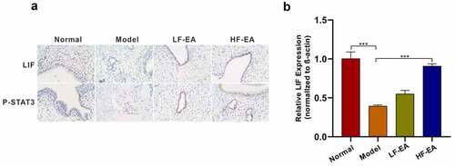 Figure 5. Electroacupuncture increased levels of LIF/ STAT3 signaling pathway. (a) Both LIF and P-STAT3 expressions in rat endometrium were detected with immunohistochemical. (b) LIF expression in rat endometrium was detected with qPCR. Data are represented as mean ± SD (n ≥ 3 experiments). *p < 0.05, **p < 0.01, ***p < 0.001, and ****p < 0.0001 as determined using Student’s t-test (two groups) or one-way ANOVA, followed by Tukey’s test (more than two groups)