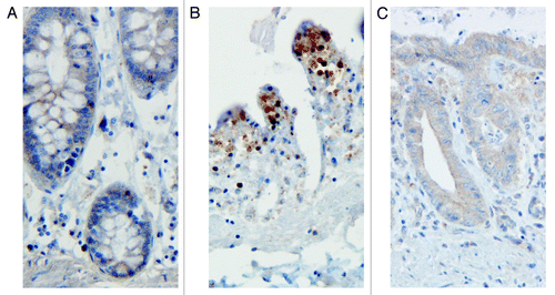 Figure 3. Non-polarized stimulation with a probiotic does not lead to extensive apoptosis or NfκB activation like Salmonella does—staining for p65 (A) Untreated tissue; (B) Tissue stimulated with Salmonella in the absence of the cylinder; © Tissue stimulated with L. paracasei in the absence of the cylinder.