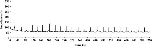 Figure 2. The demonstration of impedance changes along with the energy supply under the impedance-controlled ablation protocol.