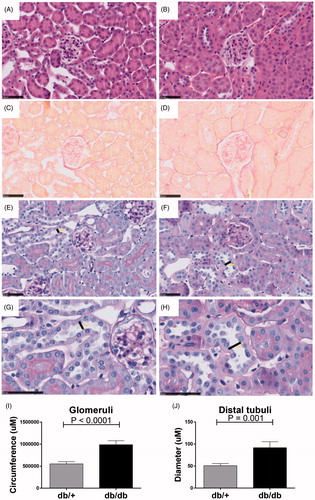 Figure 2. Structural changes in non-diabetic db/+ compared to diabetic db/db kidneys. H&E staining of db/+ (A) and db/db (B) mouse kidney. Picro-sirius red staining of db/+ (C) and db/db (D) mouse kidney. Periodic acid–Schiff staining of db/+ (E) and db/db kidney tissue (F) with magnification of a representative distal tubuli lumen diameter of db/+ (G) and db/db (H) where lumen width is indicated. Quantification of glomerular circumference (I) and distal tubular lumen diameter (J).