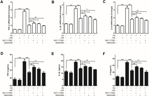 Figure 7 Effect of HIR on production of pro-inflammatory cytokines in podocytes. (A–C) qPCR analysis of the indicated TNF-α (A), IL-1β (B), and IL-6 (C) mRNA in podocytes; (D, F) ELISA assay of the indicated TNF-α (D), IL-1β (E), and IL-6 (F) protein in podocytes. Three independent replicates. When comparing between two groups, ns indicates no significance, *indicates P < 0.05, **indicates P < 0.01 and ***indicates P < 0.001.