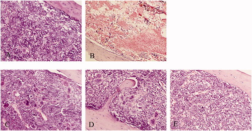 Figure 2. Influence of RRPs on histopathological changes in bone marrow in mice with aplastic anaemia. (A) Bone marrow, normal control (100×); (B) bone marrow, anaemic control (100×); (C) bone marrow, high-dose RRPs (100×); (D) bone marrow, medium-dose RRPs (100×); and (E) bone marrow, low-dose RRPs (100×). Stain, haematoxylin and eosin.