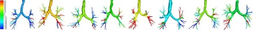 Figure 3 Variability in changes from exacerbation to stable state in siRaw at TLC in individual patients (8 patients randomly selected). The scale represents the percent change in the resistance of the different airway branches at TLC; red represents an increase in resistance, while blue represents a decrease.