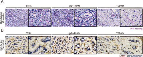 Figure 4. FGF21 deficiency induces enlarged lysosomes dependent on autophagy in the kidney of obese mice. (A and B) Representative images of PAS staining (A) and LAMP1 immunostaining (B) in the kidney cortical regions of obese CTRL, fgf21F/F-TSKO, and TSDKO mice under a high-fat diet for 2 months (n = 4 to 6). Kidney sections were counterstained with hematoxylin (A and B) and immunostained for the proximal tubule marker LRP2/MEGALIN in blue (B). Bars: 50 μm.