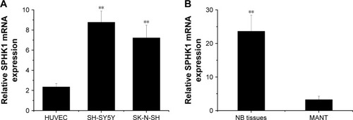 Figure 1 SPHK1 mRNA overexpression in NB cells and human NB tissues.
