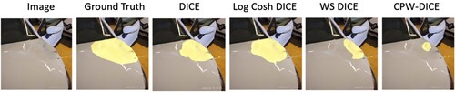 Figure 7. An example of a multi-centre dent case.