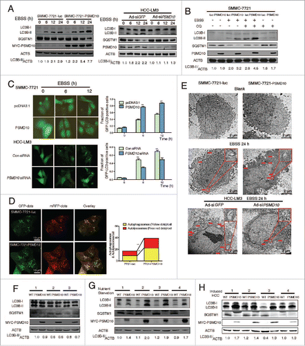 Figure 1. PSMD10 enhances autophagy in starvation. (A, B) Evaluation for LC3B-II and SQSTM1 alteration indicative of autophagy induction in SMMC-7721-luc, SMMC-7721-PSMD10, or HCC-LM3 cells infected with adenovirus-mediated siRNA against GFP (Ad-siGFP) or PSMD10 (Ad-siPSMD10) treated with Earle's balanced salt solution (EBSS) for up to 24 h (A) or EBSS plus chloroquine (CQ) for 12 h (B). (C) SMMC-7721 cells were transiently cotransfected with pcDNA3.1 or PSMD10, or HCC-LM3 cells with siCon or siPSMD10. After 18 h transfection, cells were retransfected with pGFP-LC3B plasmid and subjected to EBSS treatment for the indicated time before observation for GFP-LC3B puncta under a fluorescence microscope. The percentage of cells with accumulation of GFP-LC3B in puncta was calculated in 3 random fields. (D) Representative images of LC3B staining in SMMC-7721-luc or SMMC-7721-PSMD10 cells infected with adenovirus-delivering mRFP-GFP-LC3B and treated with EBSS for 12 h. Quantification of autophagosome and autolysosome formation representing puncta staining sites per cell of 10 independent images. (E) Representative electron micrographs of autophagic vesicles or autophagosomes of (A) for up to 24 h. Arrows denote autophagosomes. Magnified image is shown. (F, G) Immunoblot for the indicated molecules in liver tissues isolated from 8-wk-old Psmd10-transgenic mice and littermates in a fed (F) or a fasted state for 24 h (G). (H) Immunoblot in liver tumors isolated from diethylnitrosamine (DEN) plus TCPOBOP-induced HCC in Psmd10-transgenic mice and littermates. Data represent the mean ±SD of 3 independent experiments (*P < 0.05, **P < 0.01).