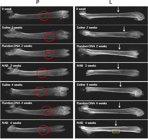 Figure 8 Potential bone defect repair and restoration of NAB in vivo. Penetrating defects were created in the femurs of rats. NAB (100 mg/kg), random DNA (100 mg/kg) or saline were administrated by iv injections each day, the perforated bones collected were at 2 or 4 weeks. X-ray was utilized to observe the reconstruction of penetrating defects. At 2 weeks, the healing of bone defects in the NAB group was blurred as the arrow pointed. At 4 weeks, the NAB group healed satisfactorily, the perforations were barely visible, and the osteotylus growth could be observed outside the cortical bone as the yellow square highlighted (The red circle and white arrow presents the bong defect; The yellow square presents osteotylus growth).