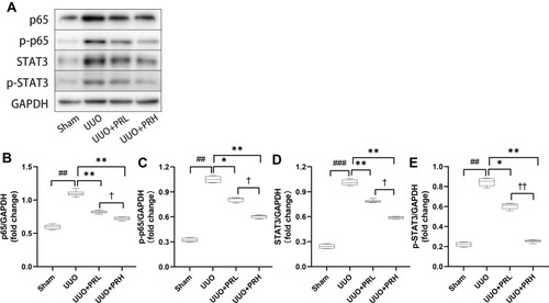 Figure 8 PR inhibits UUO-induced NF-κB p65/STAT3 signaling pathway activation. (A–E) According to the results of Wb, PR significantly inhibited the activation of the inflammatory pathway NF-κB p65/STAT3 in the kidney of UUO mice. ##P<0.01, ###P<0.001, vs Sham group; *P<0.05, **P<0.01, vs UUO group; †P<0.05, ††P<0.01, vs UUO + PRL group.