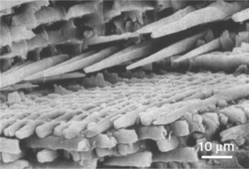 Figure 3 Scanning electron microscopy image of enamel-carbonated hydroxyapatite. ‘Spaghetti-shaped nanocrystals’ arranged in bundles oriented along three differentdirections (scale bar 10 μm).Copyright (c) 1989, Oxford University Press. Reproduced with permission from Lowestan HA, Weiner S. On Biomineralization. New York: Oxford University Press; 1989.