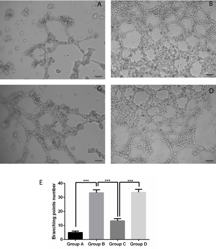 Figure 3 Effect of RhoGDI2 over-expression on regulating the A2780-induced tube formation by Ado. (A) Control group (PBS); (B) Ado group (0 μM) + cell culture supernatant; (C) Ado group (20 μM) + cell culture supernatant; (D) Ado group (20 μM) + cell culture supernatant + RhoGDI2 siRNA; (E) Tube formation quantification, ***P < 0.001.