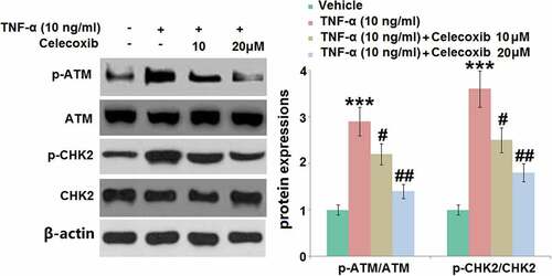 Figure 6. The effect of Celecoxib on the activation of p-ATM and p-CHK2 induced by TNF-α in human chondrocytes. Cells were treated with TNF-α (10 ng/ml) in the absence or presence of Celecoxib at the concentrations of 10, 20 μM for 6 hours. The expressions of p-ATM/ATM and p-CHK2/CHK2 were detected using western blots (***, P < 0.005 vs. vehicle group; #, ##, P < 0.05, 0.01 vs. TNF-α group)