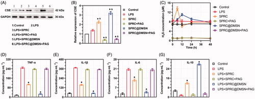 Figure 3. Supplementations exerted anti-inflammation effects via CSE/H2S pathway in vitro. (A, B) Changes of CSE expression after co-incubation with different supplementations. Significant different compared with control group indicated as (*), and significant different compared with LPS group indicated as (&) (n = 3, mean ± SD). (C) The H2S release in vitro after co-incubation with different supplementations (n = 3, mean ± SD). The pro-inflammatory cytokines levels of (D) TNF-α, (E) IL-1β, (F) IL-6, and anti-inflammatory cytokine level of (G) IL-10 were measured. Significant different compared with LPS treated group indicated as (*) (n = 3, mean ± SD).