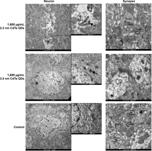 Figure 4 Transmission electron microscopy images of hippocampus of rats treated with 2.2 nm and 3.5 nm MPA-capped CdTe QDs. The arrows indicate accumulated QDs in the lysosome.Note: The insets are magnifications of parts of neurons.Abbreviations: MPA, 3-mercaptopropionic acid; QDs, quantum dots; M, mitochondria; N, nucleus; L, lysosome; NC, nucleolus; PreM, presynaptic membrane; postM, postsynaptic membrane; RER, rough endoplasmic reticulum.