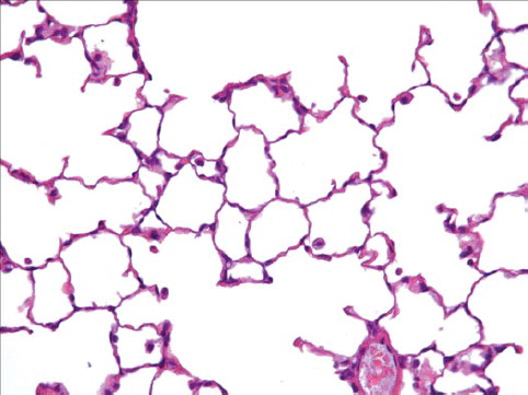 FIG. 13  Histopathological photo of control lung from a group 1 rat exposed to filtered air using a similar generator and exposure system (40× magnification). A few macrophages are seen.