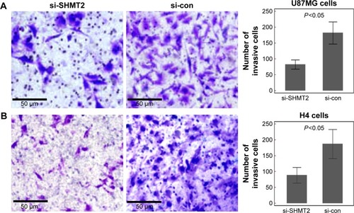 Figure 4 SHMT2 regulates cell invasion of glioma cells in vitro.