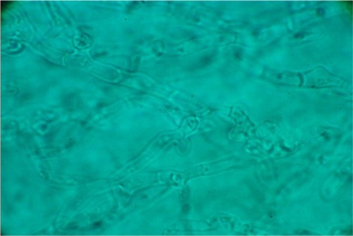 Figure 2 Trichophyton violaceum (lactophenol cotton blue mount).