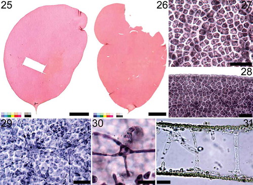 Figs 25‒31. Nesoia pulchella sp. nov. Fig. 25. Holotype, MSK150524-16, Dodu, Jeju Island, Korea, vegetative. Fig. 26. Topotype, MSK150601-06, vegetative. Fig. 27. Cortical cells in surface view. Fig. 28. Entire margin of blade. Fig. 29. Subcortical stellate cells and filaments. Fig. 30. A subcortical stellate cell. Fig. 31. Cross-section of a blade showing the medulla composed of anticlinal filaments. Scale bars: Figs 25‒26 = 1 cm; Figs 27‒29, 31 = 30 μm; Fig. 30 = 10 μm.