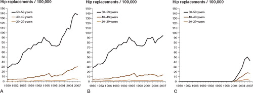 Figure 3. A. Incidence of all hip arthroplasties for primary osteoarthritis in young patients (30–59 years of age), by age group. B. Incidence of total hip arthroplasty (THA) for primary osteoarthritis in young patients (30–59 years of age), by age group. C. Incidence of resurfacing hip arthroplasty (RHA) for primary osteoarthritis in young patients (30–59 years of age), by age group.