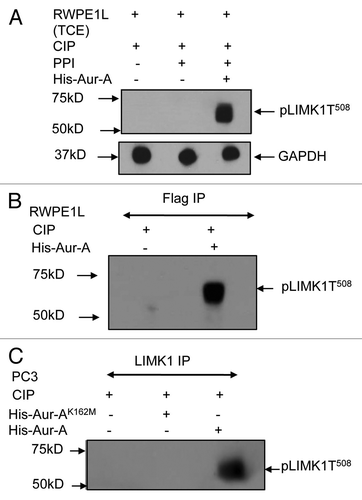 Figure 5 Aur-A allows T508 phosphorylation on endogenously expressed LIMK1. (A) Nonradioactive kinase assays using calf intestinal phosphatase (CIP) (5 units) treated extracts (50 µg) of RWPE-1 cells transfected with pCMVLIMK1-FLAG. CIP-treated extracts were incubated with His-Aur-A (0.22 µg) with phosphatase inhibitor (PPI) (lane 3), and phosphopeptide band was detected by western blotting using anti-p508-LIMK1 antibodies. Data show strong phosphorylation at T508 by His-Aur-A but not without Aur-A. No phosphorylated LIMK1 (T508) could be seen in the absence of PPI (lane 1). GAPDH was used as the loading control. (B) and (C) Nonradioactive kinase assays using immunoprecipitated FLAG-tagged LIMK1 from CIP treated (100 units) transfected RWPE-1 cell extracts (500 µg) or LIMK1 from CIP treated (100 units) PC-3 cell extracts (500 µg) and His-Aur-A (0.22 µg). Phosphorylated LIMK1 at T508 was detected by immunoblotting using anti-pT508-LIMK1 antibodies. (B) A strong phosphorylated band of FLAG-LIMK1 at T508 was evident upon incubation with His-Aur-A but not in the lane without Aur-A. (C) A similar phosphorylation at T508 of immunoprecipitated LIMK1 by His-Aur-A was noted (lane 3) which was not seen upon incubation with Aur-AK162M, which confirms the requirement of active Aur-A to achieve phosphorylation at T508 of LIMK1. Data show a representative image of at least three independent experiments.