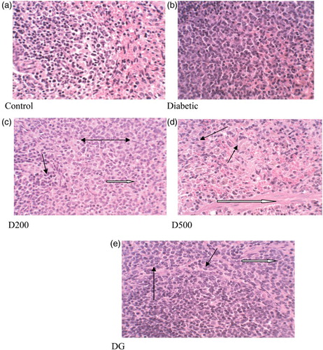 Figure 6. Histopathological changes (× 400) in pancreas of control and alloxan-induced diabetic rats. Control: normal pancreatic islets of Langerhans and acini. Diabetic: degeneration and shrinkage (white arrow), vacuolar change (black arrow), necrotic cells (black double-headed arrow), haemosiderosis; D200: reduced necrosis (black arrow), degeneration (white arrow) and irregular spaces (double arrow). D500: reduced necrosis (white arrow), degeneration (black arrows). DG: reduced cellular degeneration and vacuolar swelling (black arrows), mild haemosiderosis (white arrow).