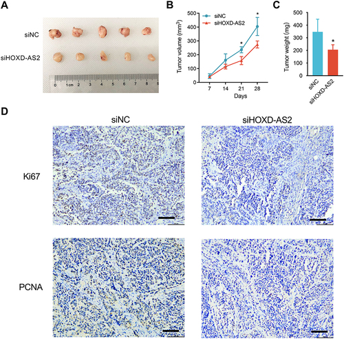 Figure 5 Knockdown of HOXD‐AS2 suppresses HCC growth in subcutaneous xenograft nude mouse model. (A) Photograph of dissected subcutaneous tumors at sacrificed time. (B) The volume of the subcutaneous tumors was measured every 7 days after implantation. (C) Tumor weight of dissected subcutaneous tumors at sacrificed time. (D) The expression of proliferative markers Ki67 and PCNA in subcutaneous tumors were detected by IHC staining, scale bar =100 μm. siNC, negative control; siHOXD-AS2, HOXD-AS2 knockdown group. Data are given as mean ± SD (n = 5). *p < 0.05.