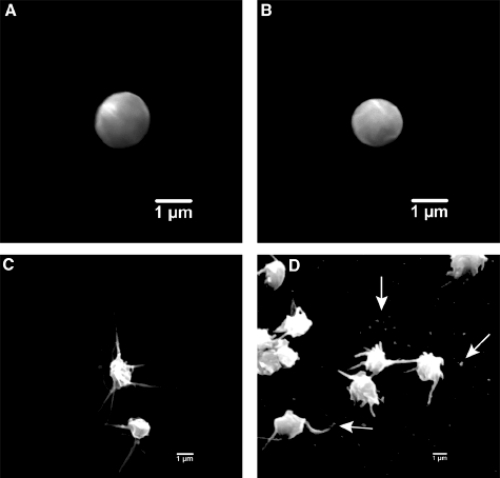 Figure 4 Scanning electron photomicrographs representing differences in platelet activation between anticoagulants. (A) normal platelet at rest, (B) platelet response to bivalirudin therapy, (C) platelet response and activation with UFH therapy, (D) platelet response (release of microparticles) after UFH therapy. Reprinted with permission from CitationAnand SX, Kim MC, Kamran M, et al. 2007. Comparison of platelet function and morphology in patients undergoing percutaneous coronary intervention receiving bivalirudin versus unfractionated heparin versus clopidogrel pretreatment and bivalirudin. Am J Cardiol, 100:417–24. Copyright © 2007 Elsevier.